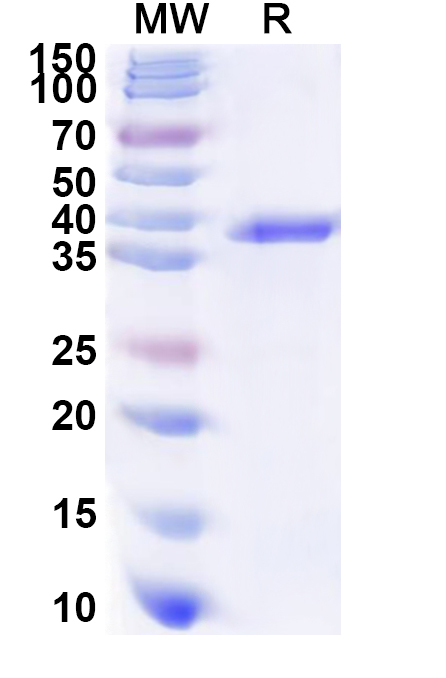 SDS-PAGE for Recombinant Human GNAZ Protein, N-His