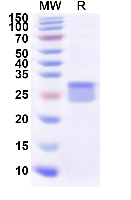 SDS-PAGE for Recombinant Human GNGT1 Protein, N-His-KSI