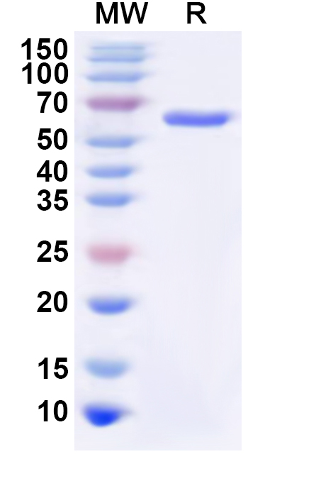 SDS-PAGE for Recombinant Human GNS Protein, N-His