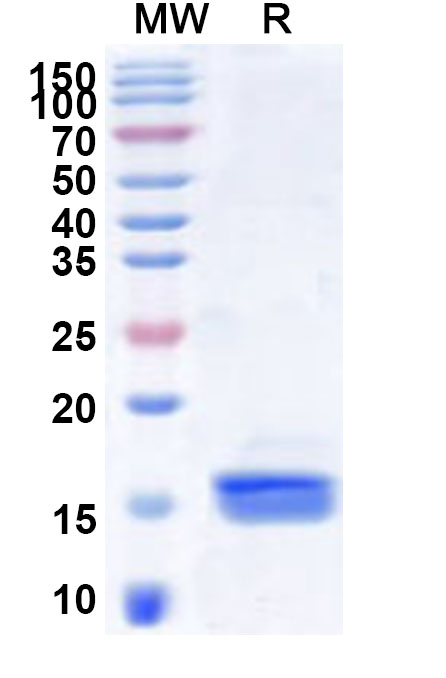SDS-PAGE for Recombinant Human GPD2 Protein, N-His