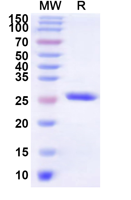 SDS-PAGE for Recombinant Human GPER1 Protein, N-His-KSI