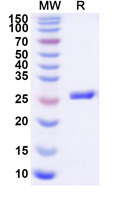 SDS-PAGE for Recombinant Human GPR143 Protein, N-His-KSI