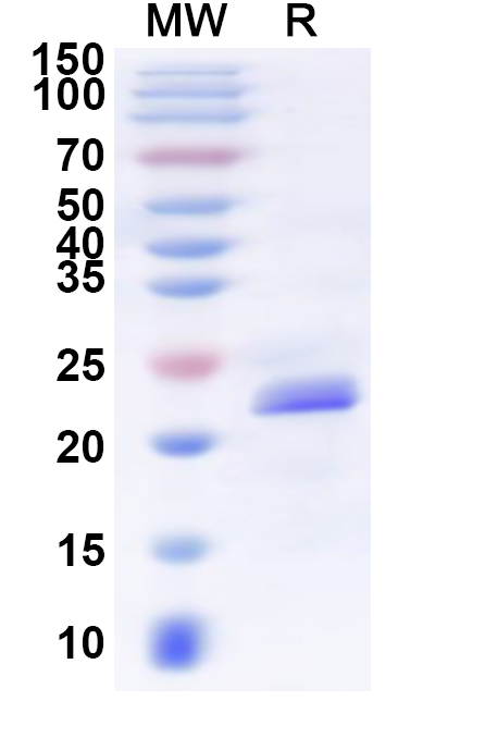 SDS-PAGE for Recombinant Human GPR39 Protein, N-His