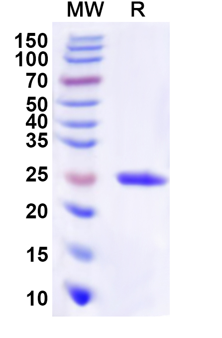 SDS-PAGE for Recombinant Human GPR4 Protein, N-His-KSI