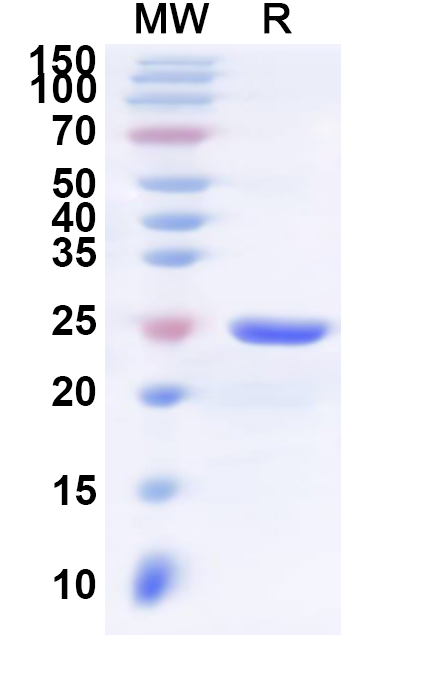 SDS-PAGE for Recombinant Human GPR68 Protein, N-His-KSI