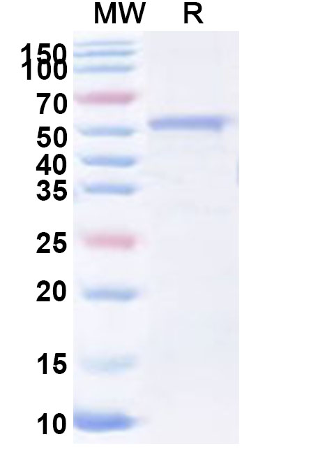 SDS-PAGE for Recombinant Human GPS2 Protein, N-His-KSI
