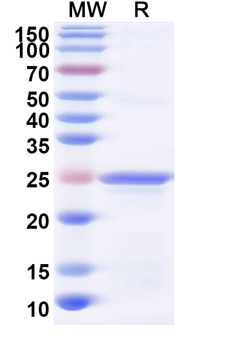 SDS-PAGE for Recombinant Human GPX5 Protein, N-His