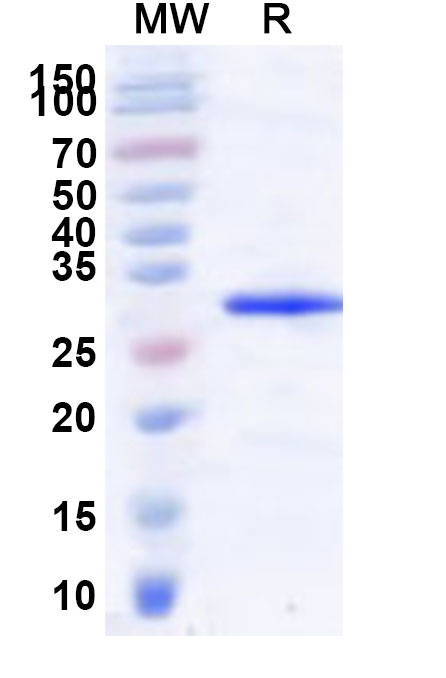 SDS-PAGE for Recombinant Human GRK3 Protein, N-His