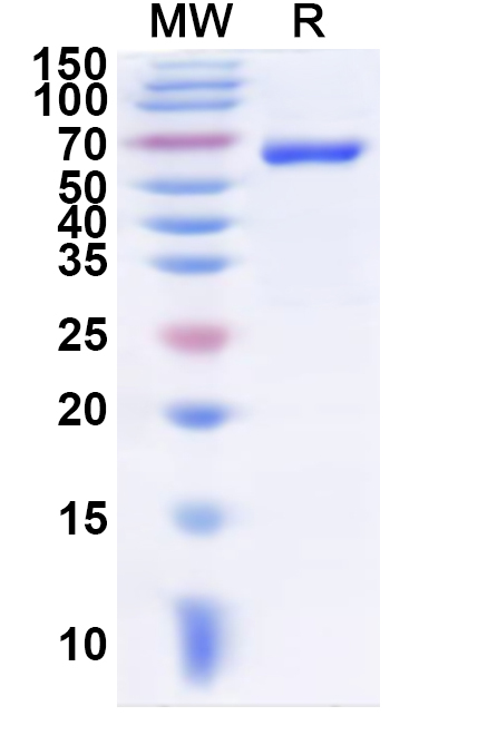 SDS-PAGE for Recombinant Human GRM7 Protein, N-His