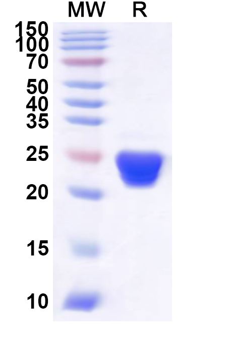 SDS-PAGE for Recombinant Human GRSF1 Protein, N-His