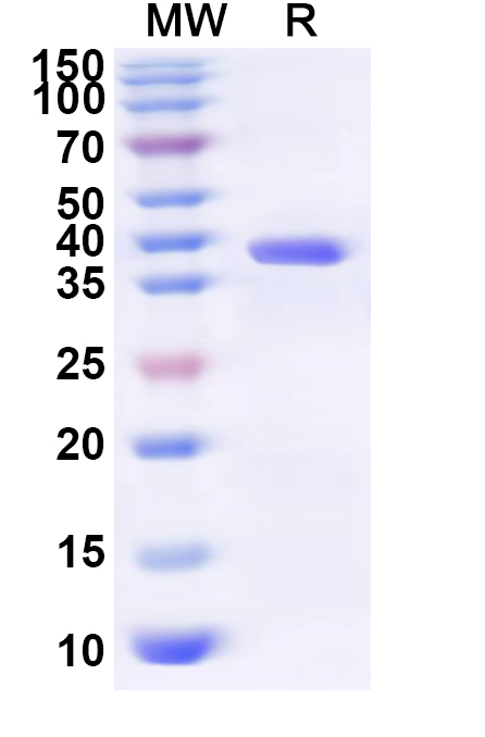 SDS-PAGE for Recombinant Human GTF2A1 Protein, N-His-KSI