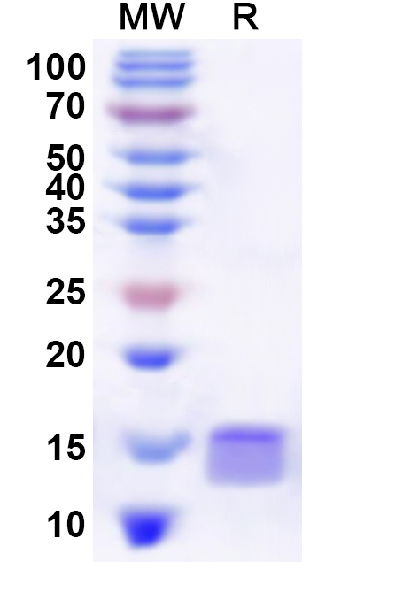 SDS-PAGE for Recombinant Human GTF2A2 Protein, N-His
