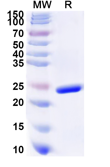 SDS-PAGE for Recombinant Human GTF2E2 Protein, N-His