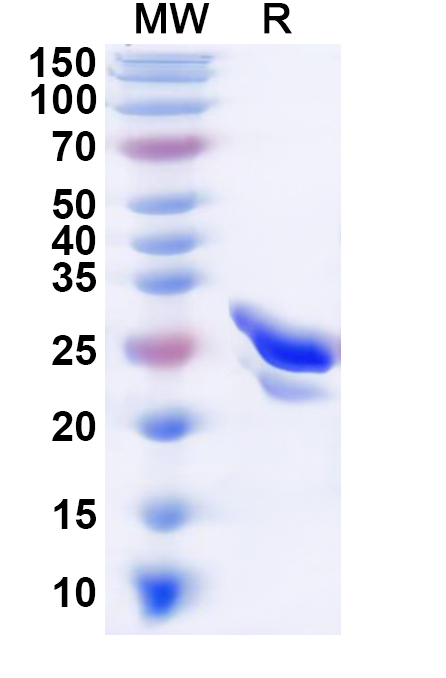 SDS-PAGE for Recombinant Human GTF2F1 Protein, N-His