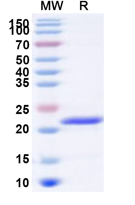 SDS-PAGE for Recombinant Human GTF2H2 Protein, N-His