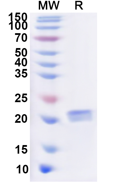 SDS-PAGE for Recombinant Human GUCA1A Protein, N-His