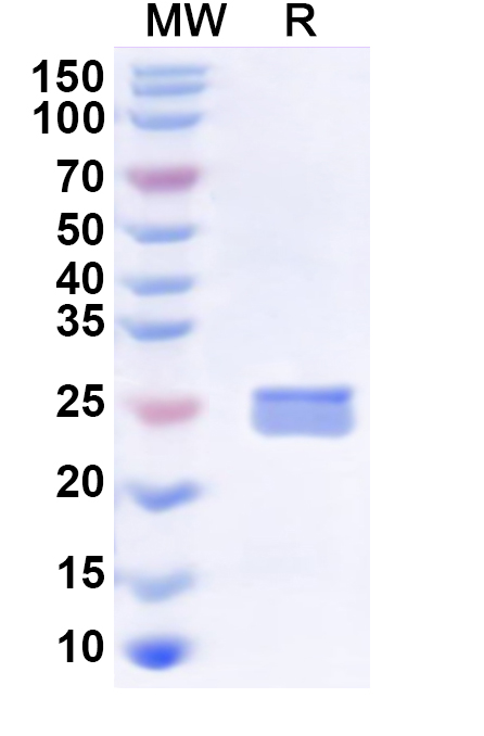 SDS-PAGE for Recombinant Human GUCY1A2 Protein, N-His