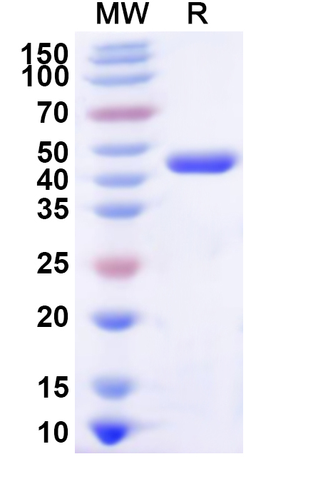 SDS-PAGE for Recombinant Human HARS2 Protein, N-His