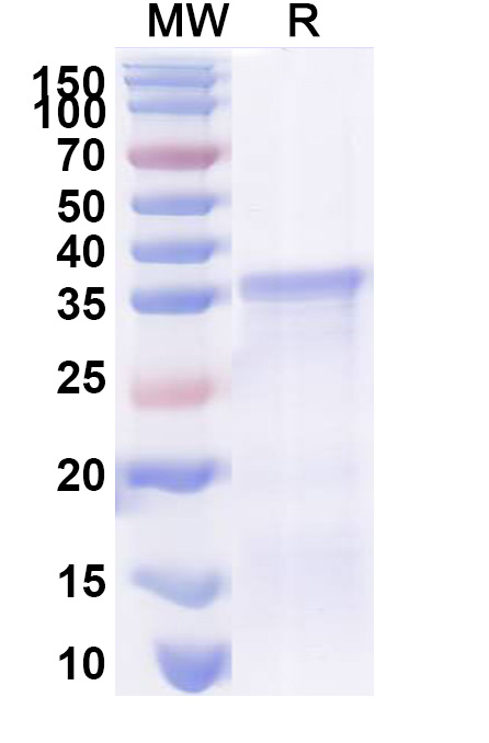 SDS-PAGE for Recombinant Human HLA-A Protein, N-His