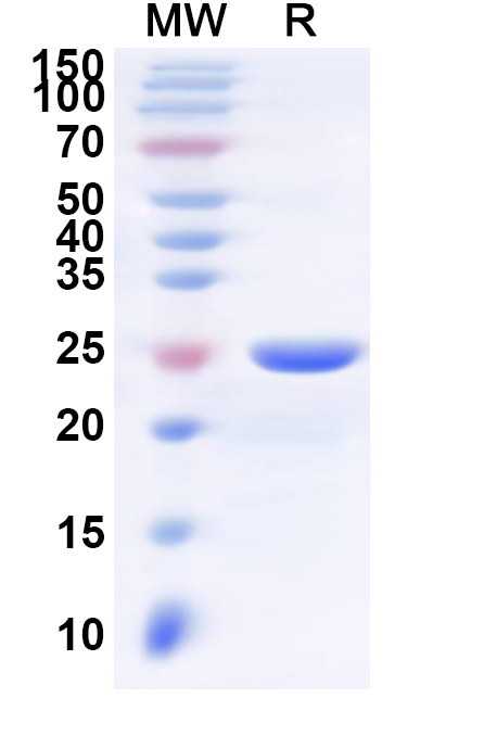 SDS-PAGE for Recombinant Human HLA-DPA1 Protein, N-His
