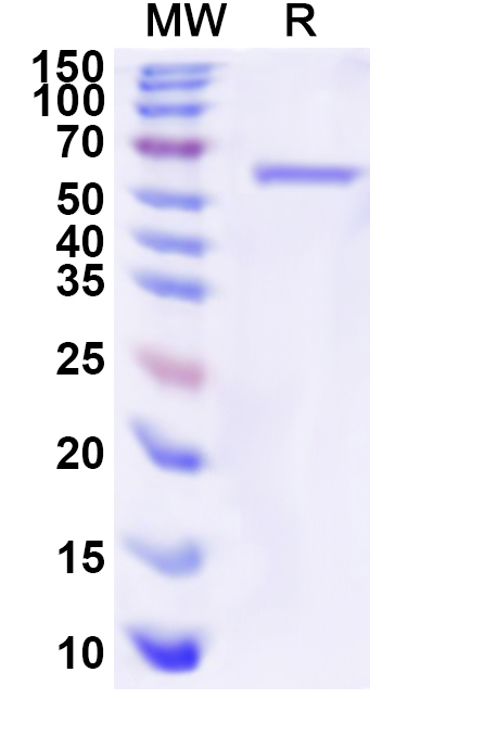 SDS-PAGE for Recombinant Human HLCS Protein, N-His