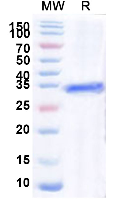 SDS-PAGE for Recombinant Human HLX Protein, N-GST & C-His