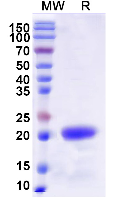 SDS-PAGE for Recombinant Human HMGA2, N-His