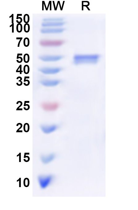 SDS-PAGE for Recombinant Human HMGCS2 Protein, N-His
