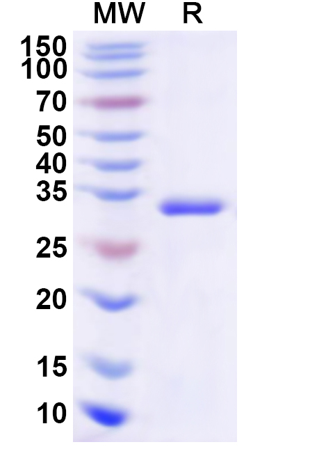 SDS-PAGE for Recombinant Human HNMT Protein, N-His
