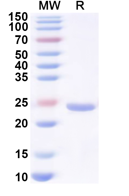 SDS-PAGE for Recombinant Human HNRNPA0 Protein, N-His