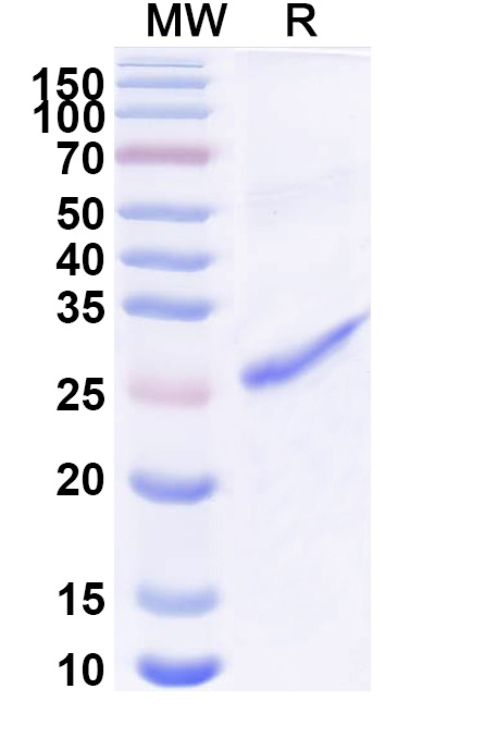 SDS-PAGE for Recombinant Human HNRNPH1 Protein, N-His