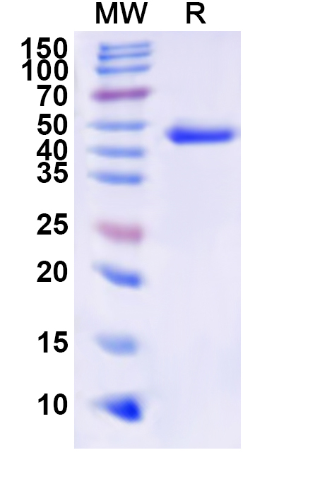 SDS-PAGE for Recombinant Human HOXB9 Protein, N-His-KSI