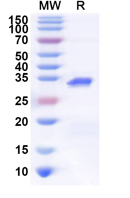 SDS-PAGE for Recombinant Human HP1BP3 Protein, N-His