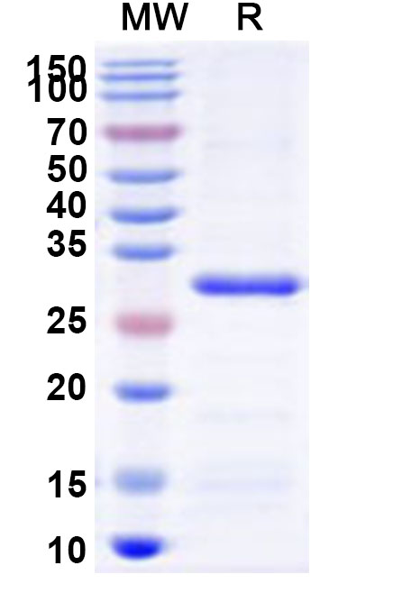SDS-PAGE for Recombinant Human HR Protein, N-His