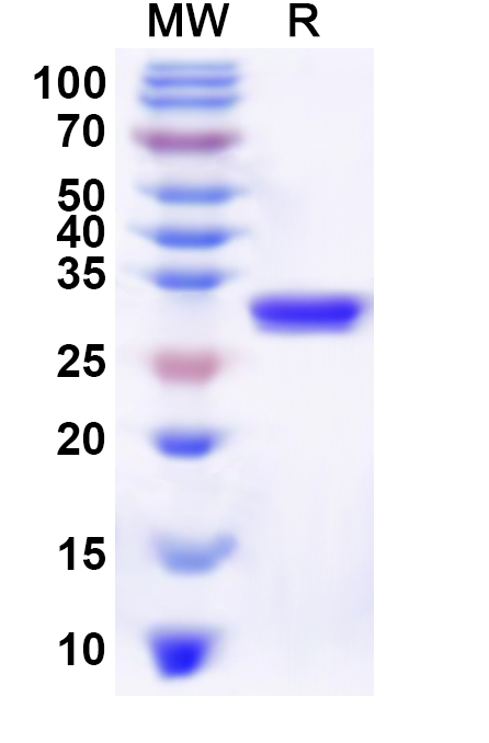 SDS-PAGE for Recombinant Human ID2 Protein, N-His-KSI