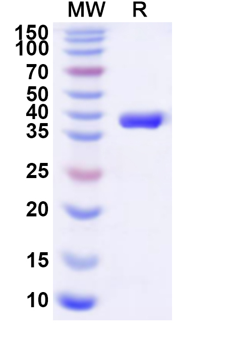 SDS-PAGE for Recombinant Human IDH3G Protein, N-His