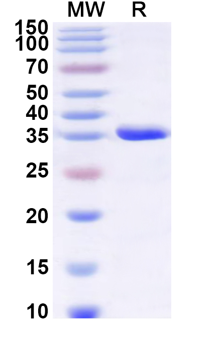 SDS-PAGE for Recombinant Human IFITM1 Protein, N-GST & C-His