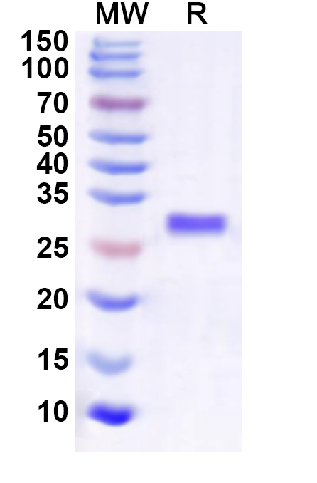 SDS-PAGE for Recombinant Human IGBP1 Protein, N-His