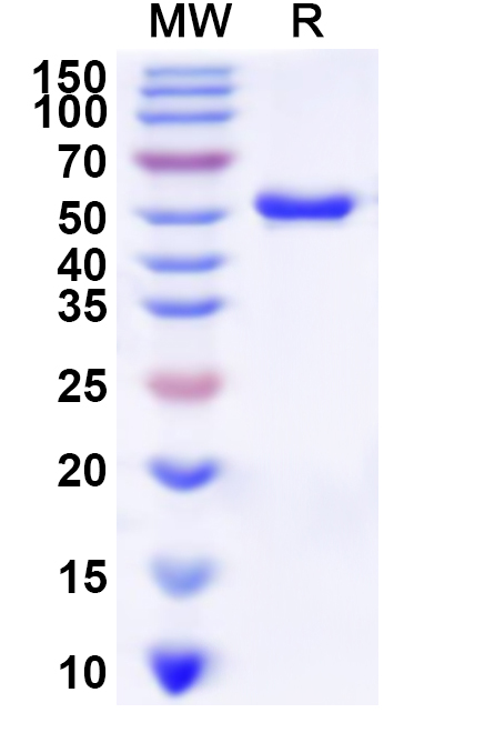 SDS-PAGE for Recombinant Human IGFALS Protein, N-His