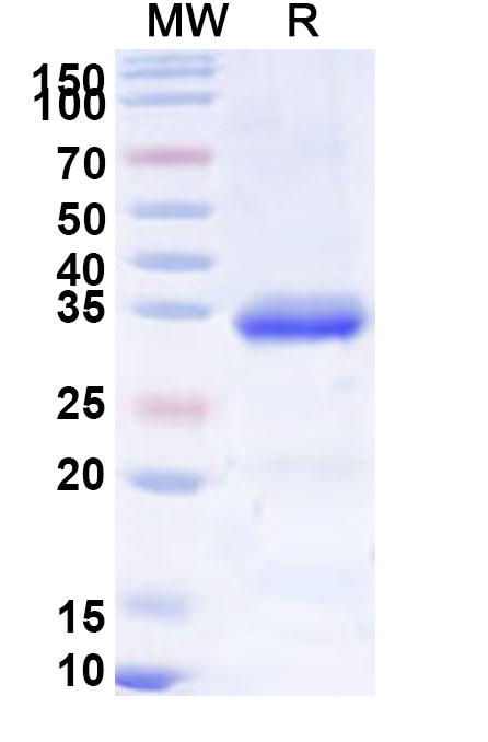 SDS-PAGE for Recombinant Human IGFBP5 Protein, N-His-SUMO&C-Strep