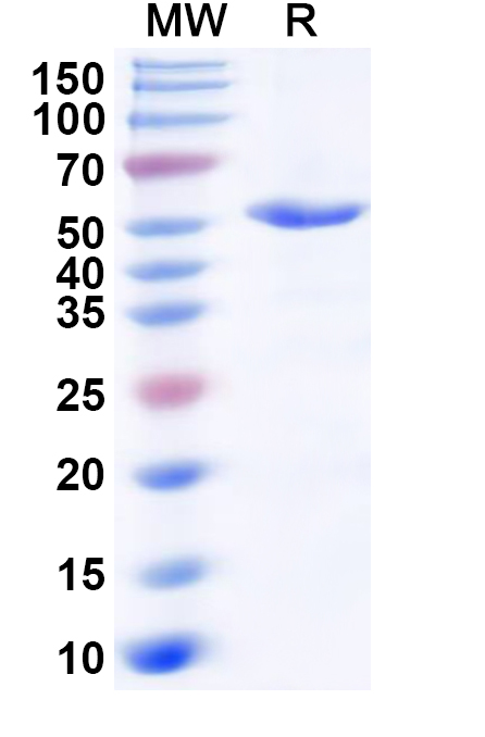 SDS-PAGE for Recombinant Human IGHMBP2 Protein, N-His