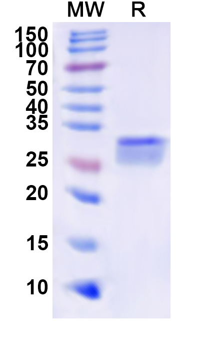 SDS-PAGE for Recombinant Human IKZF3 Protein, N-His