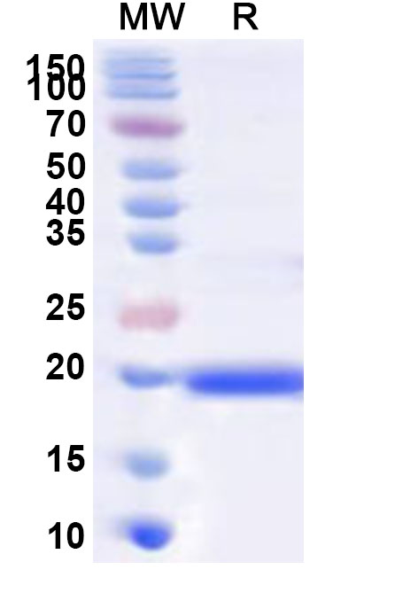 SDS-PAGE for Recombinant Human IL1F10 Protein, N-His