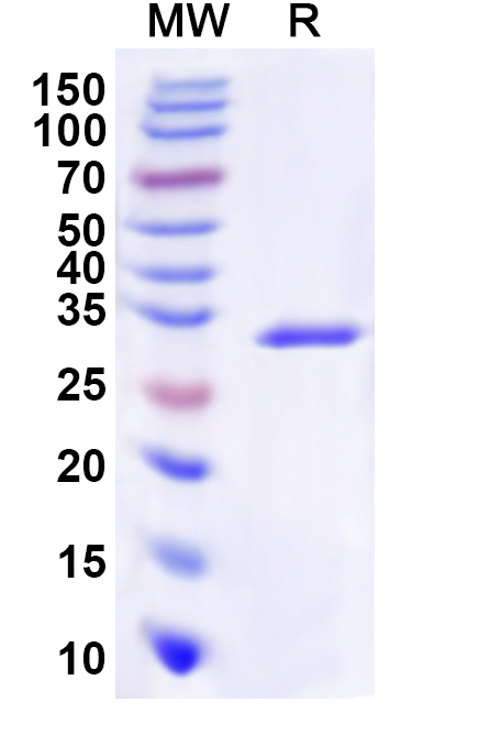 SDS-PAGE for Recombinant Human IMPA1 Protein, N-His
