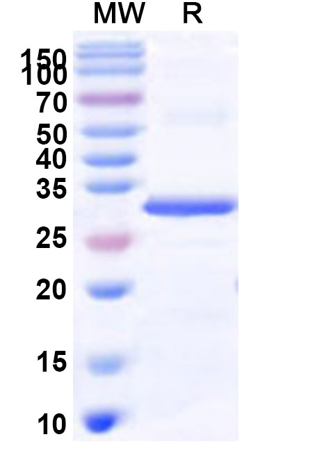 SDS-PAGE for Recombinant Human INSRR Protein, N-His