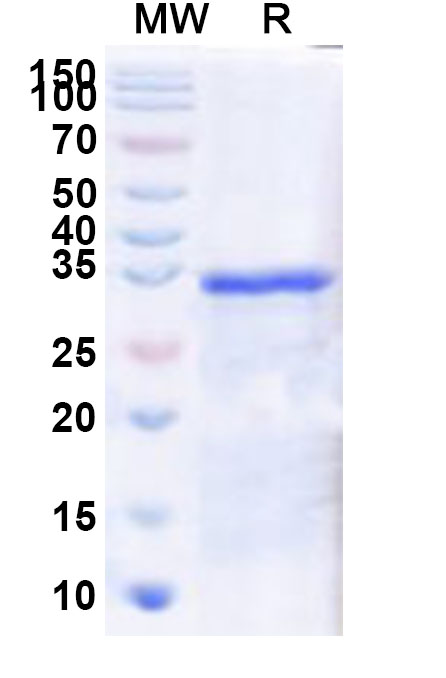 SDS-PAGE for Recombinant Human IRX4 Protein, N-GST & C-His
