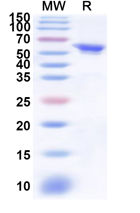 SDS-PAGE for Recombinant Human ITK Protein, N-His