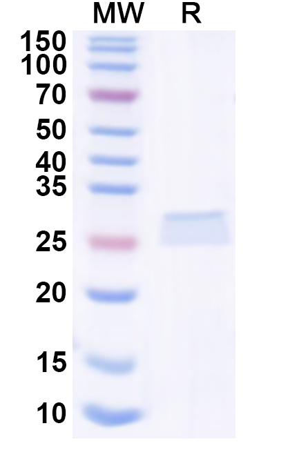 SDS-PAGE for Recombinant Human ITPRIPL1 Protein, N-His-KSI