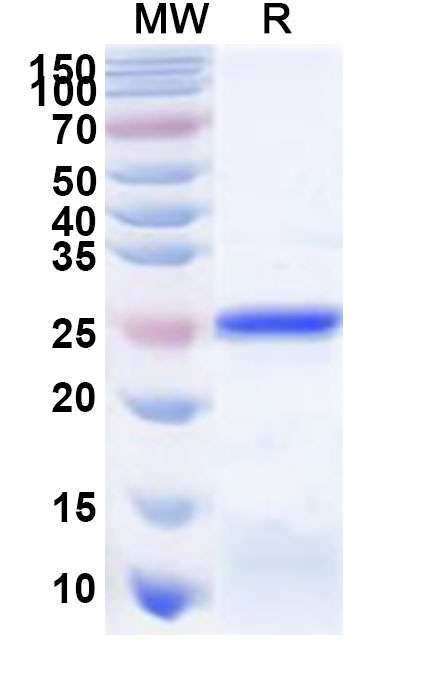 SDS-PAGE for Recombinant Human IYD Protein, N-His
