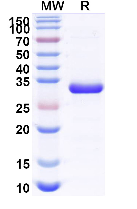 SDS-PAGE for Recombinant Human JAK1, N-His